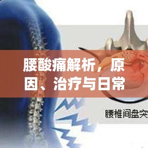 腰酸痛解析，原因、治療與日常護(hù)理，百度收錄必備指南