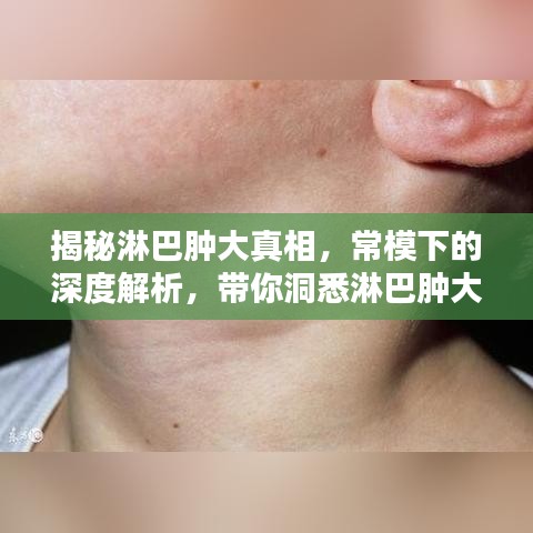 揭秘淋巴腫大真相，常模下的深度解析，帶你洞悉淋巴腫大奧秘！