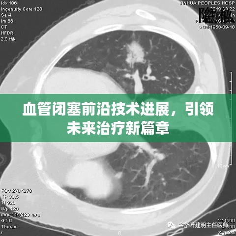 血管閉塞前沿技術(shù)進(jìn)展，引領(lǐng)未來(lái)治療新篇章