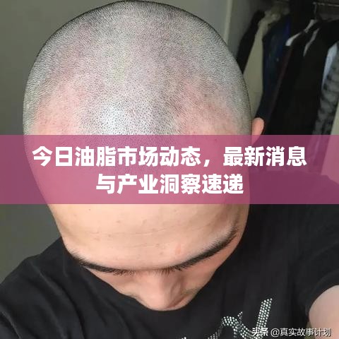 今日油脂市場(chǎng)動(dòng)態(tài)，最新消息與產(chǎn)業(yè)洞察速遞