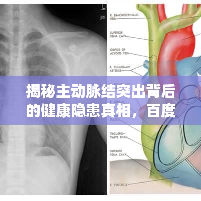 揭秘主動脈結(jié)突出背后的健康隱患真相，百度權(quán)威解讀！
