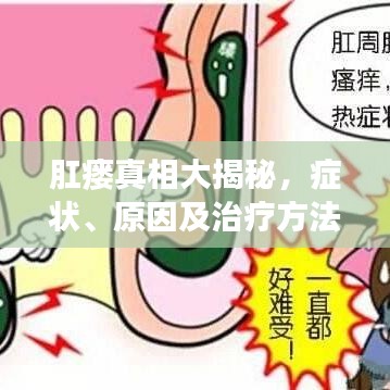 肛瘺真相大揭秘，癥狀、原因及治療方法，百度權(quán)威解讀！